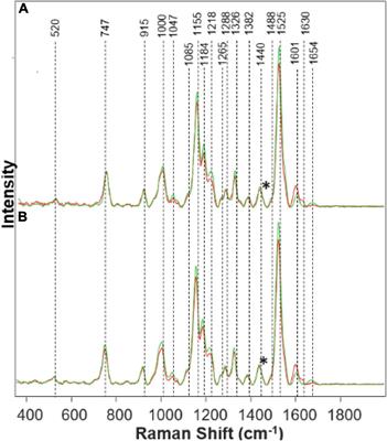 Raman Spectroscopy Enables Non-invasive and Confirmatory Diagnostics of Aluminum and Iron Toxicities in Rice